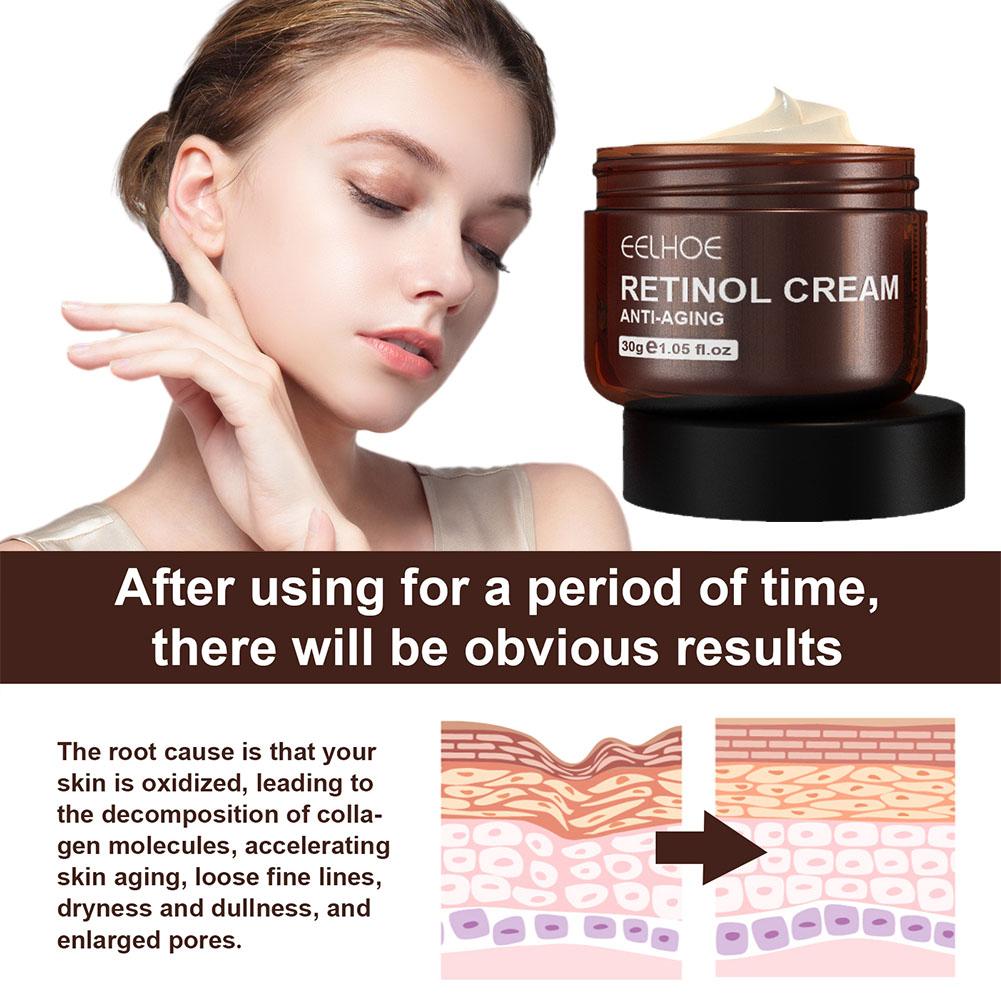 EELHOE 1/2/3/5PCS (Beli 3 Grat - Retinol Anti Wrinkle Cream ulasan dan harga