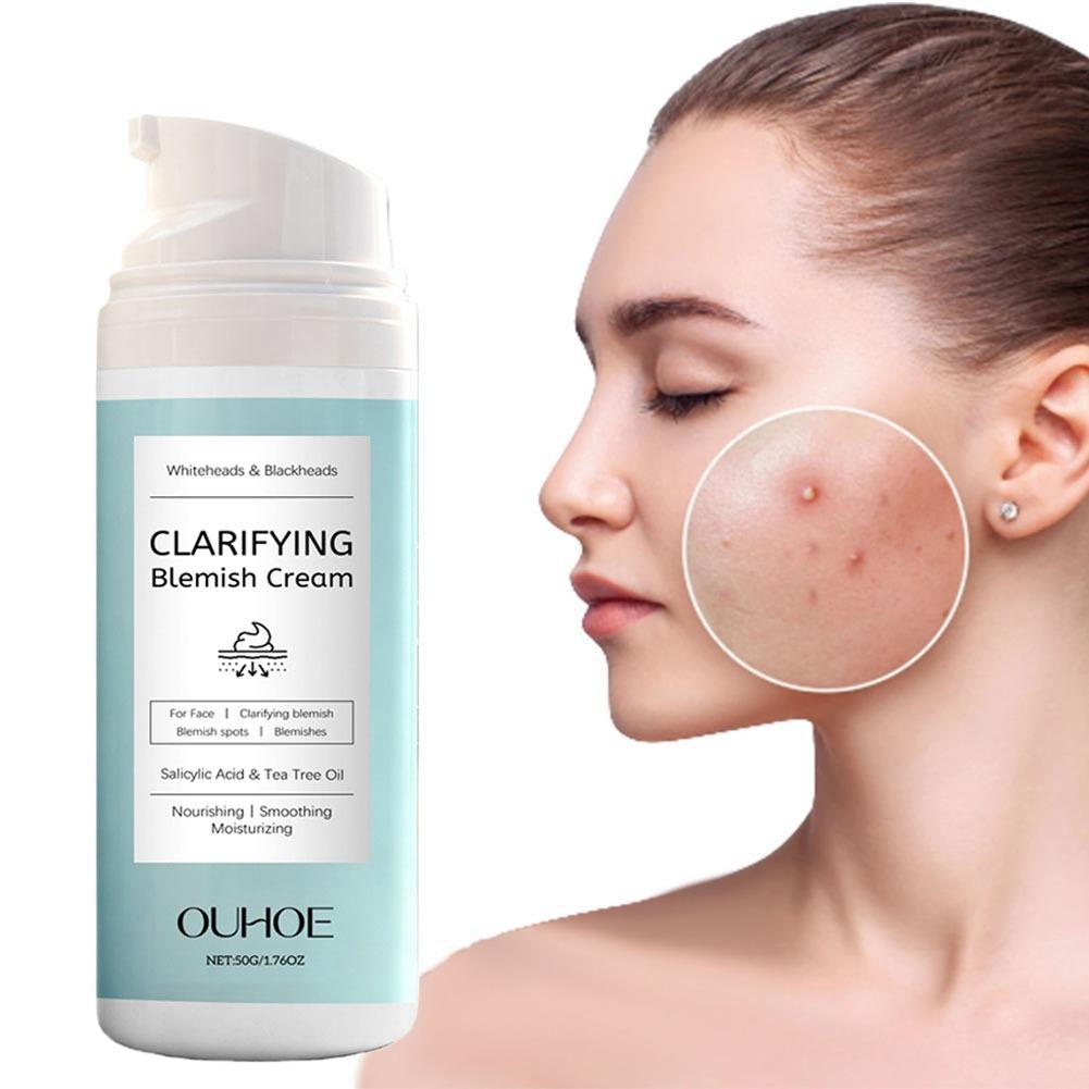 Krim Penghilang Jerawat Asam S - Salicylic Acid Blackhead Remover ulasan dan harga